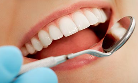 Composite Bonding: The Quick Fix for a Flawless Smile